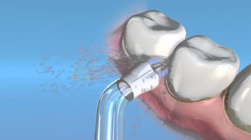 WATERPIK-WPS-2E-mosty-implanty-dysze-do-irygartora-WF-05-06.jpg