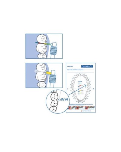 iap-sonde.jpg