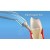 koncowki-poddziaslowe-do-irygatora-waterpik-pp-100 (1).jpg