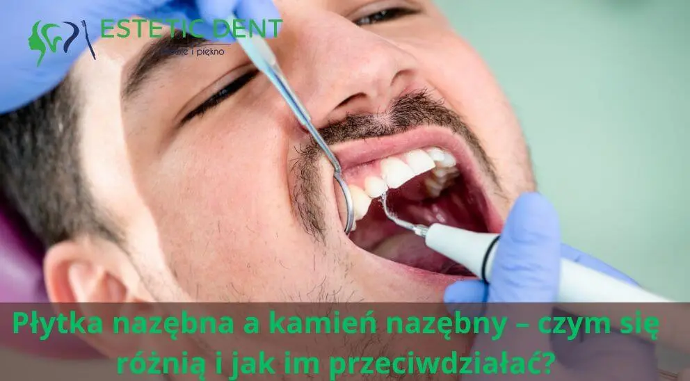 Płytka nazębna a kamień nazębny – czym się różnią i jak im przeciwdziałać?