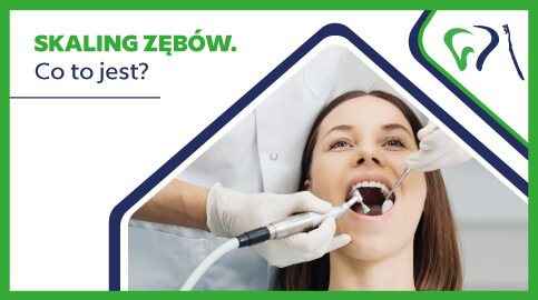 Skaling zębów – co to jest?