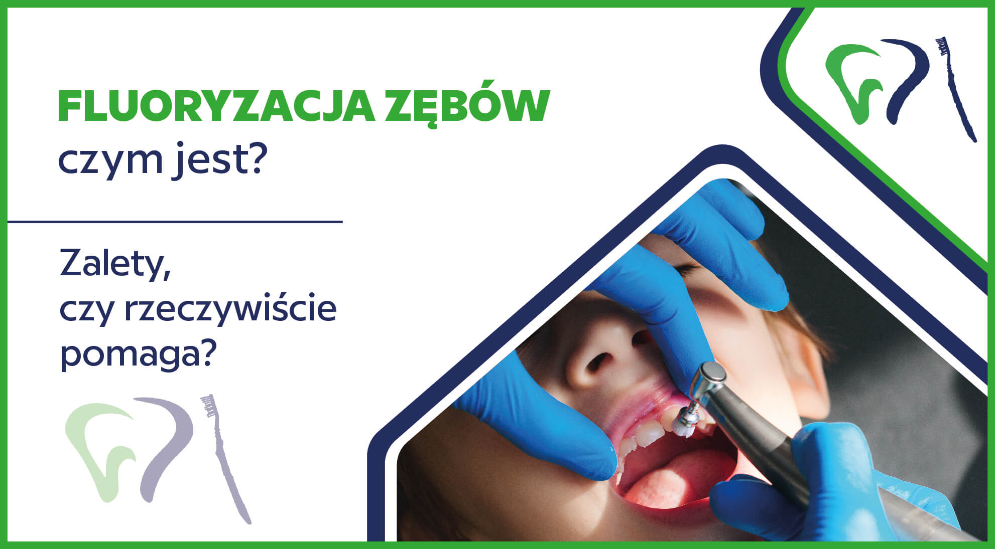Fluoryzacja zębów – czym jest, zalety, czy rzeczywiście pomaga?