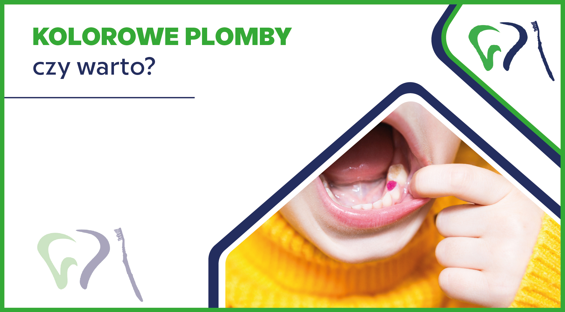 Kolorowe plomby - czy warto?