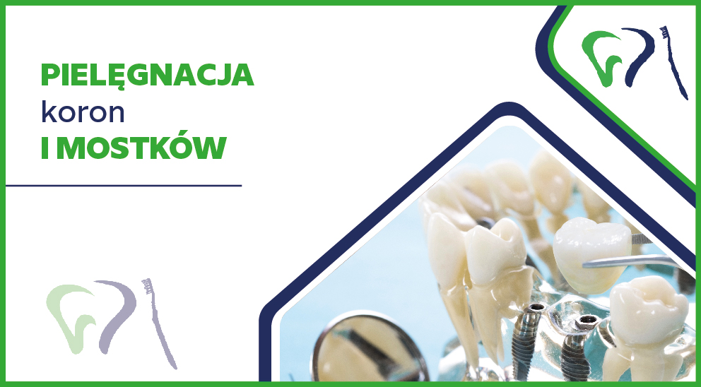 Pielęgnacja koron i mostków