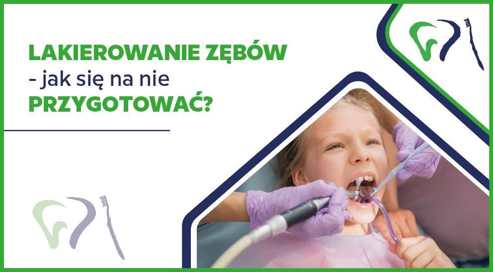 Lakierowanie zębów — jak się na nie przygotować?
